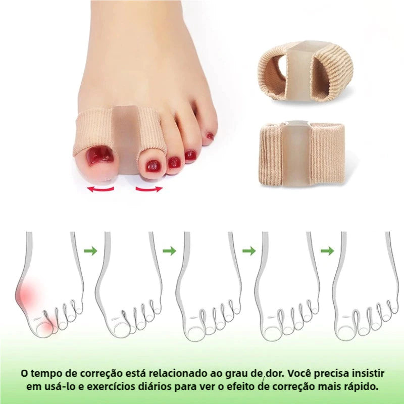 Corretor de Joanete em Silicone – Alinhador de Dedo